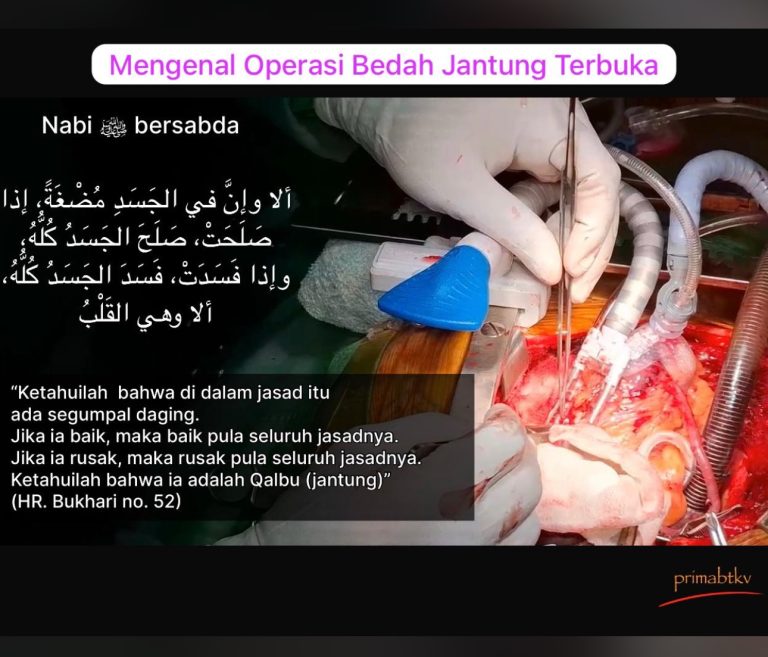 Mengenalkan operasi bedah jantung