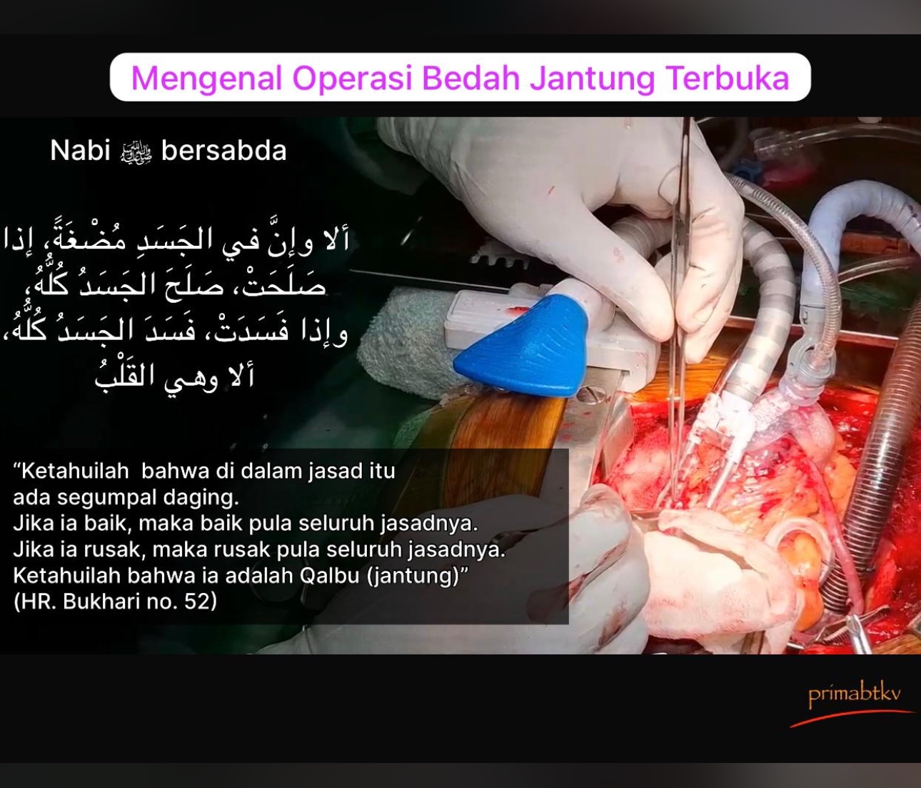 Mengenalkan operasi bedah jantung