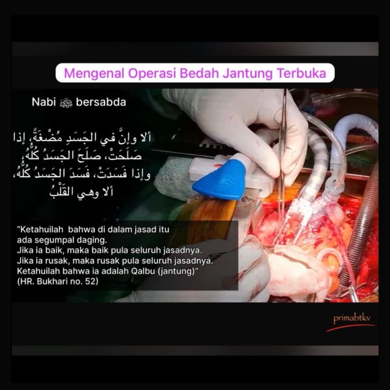 Operasi Bedah Jantung Terbuka (Open Heart Surgery)
